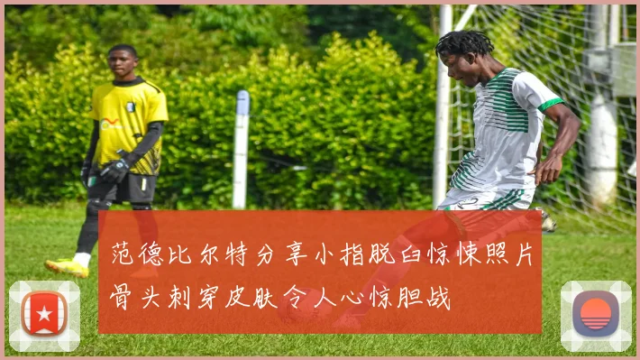 范德比尔特分享小指脱臼惊悚照片骨头刺穿皮肤令人心惊胆战